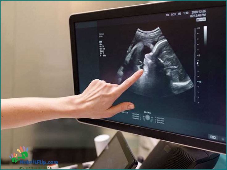3D Ultrasound at 13 Weeks What to Expect and Benefits