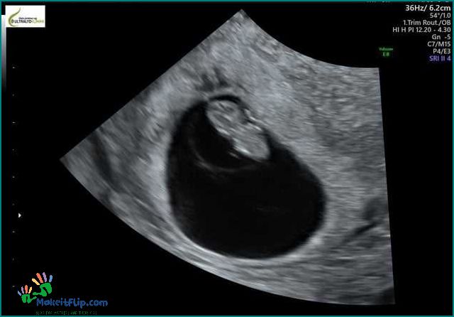 7 Week Ultrasound What to Expect and What It Can Reveal