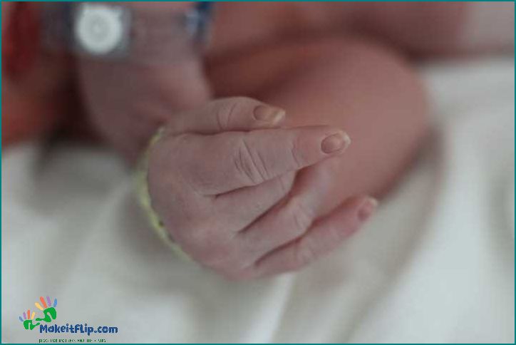 Acrocyanosis in Newborns Causes Symptoms and Treatment