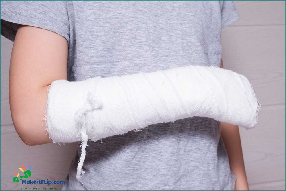 Arm Cast Everything You Need to Know About Casts for Arm Injuries