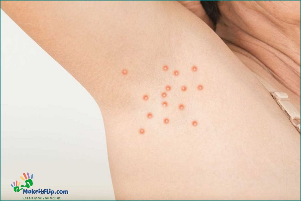 Armpit Pimple Causes Treatment and Prevention