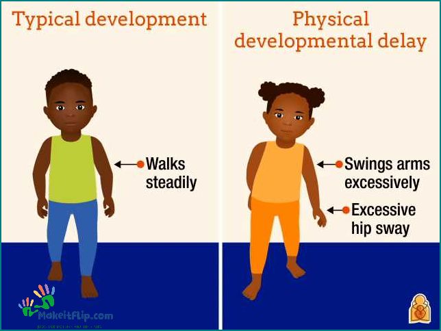 Common Reasons for Late Walking in Babies Understanding the Developmental Milestones