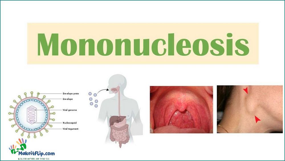 Common Symptoms of Mono in Children Causes Treatment and Prevention
