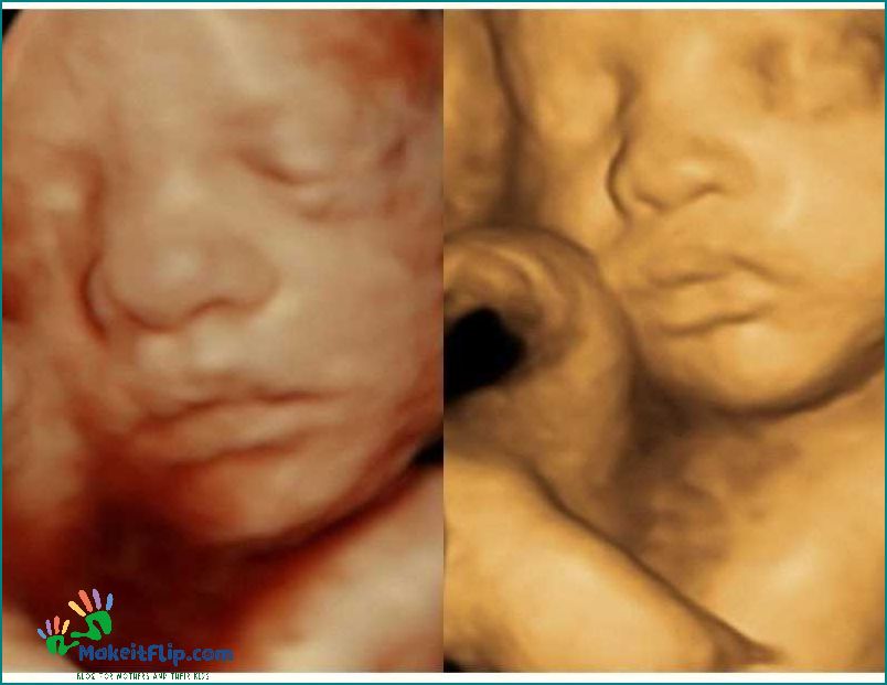 22 Week 3D Ultrasound What to Expect and How to Prepare