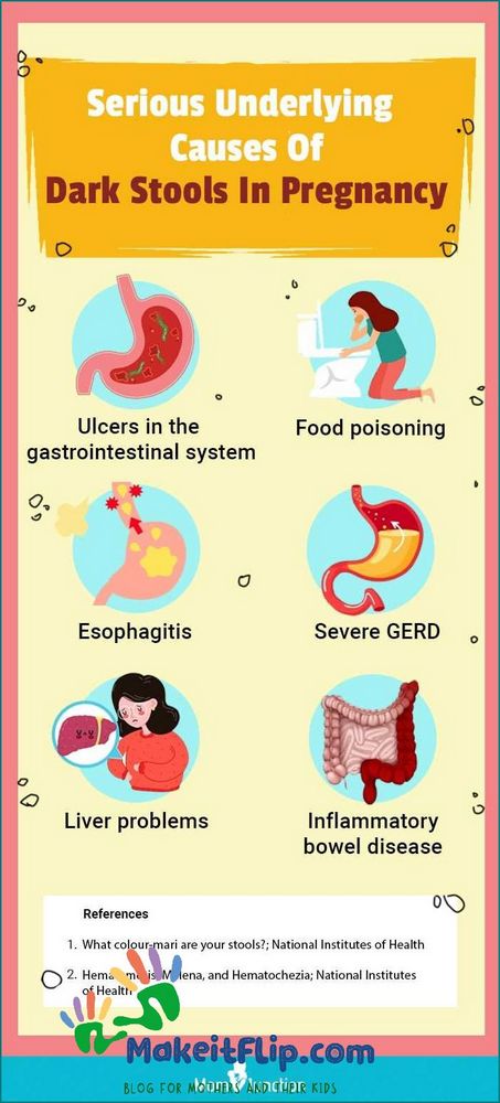 Green Poop During Pregnancy Causes Symptoms and Treatment
