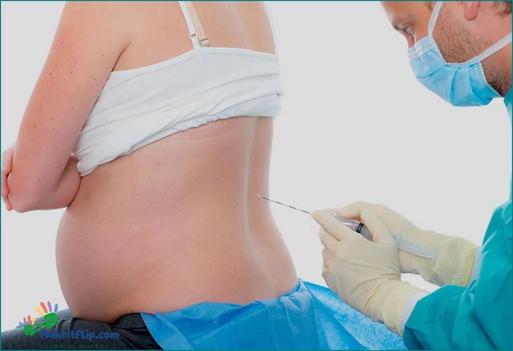 C Section Anesthesia Everything You Need to Know