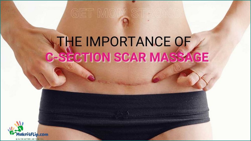 C Section Scar Massage Techniques and Benefits