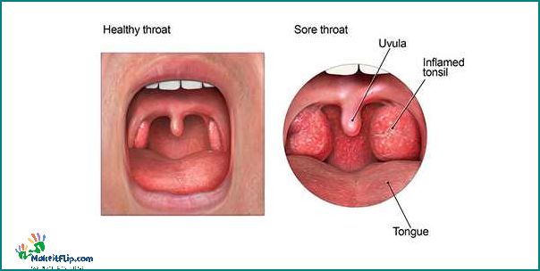 Can Allergies Cause Sore Throat Understanding the Link Between Allergies and Throat Discomfort