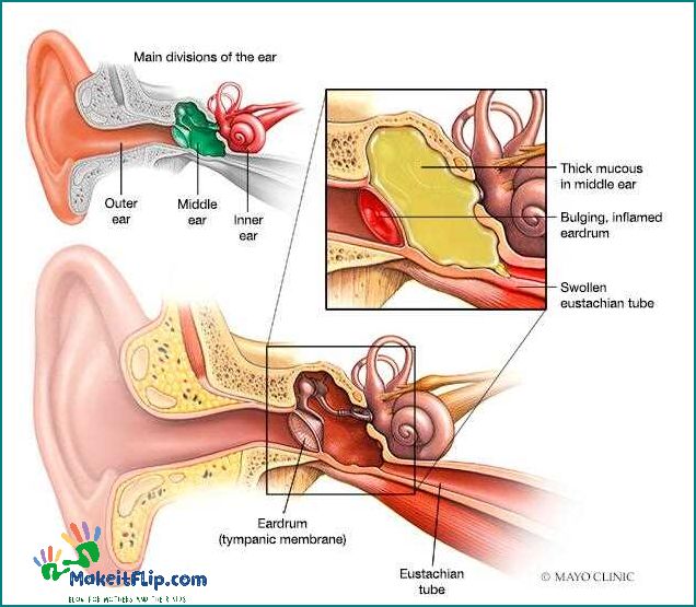 Can an Ear Infection Cause Vomiting Exploring the Connection