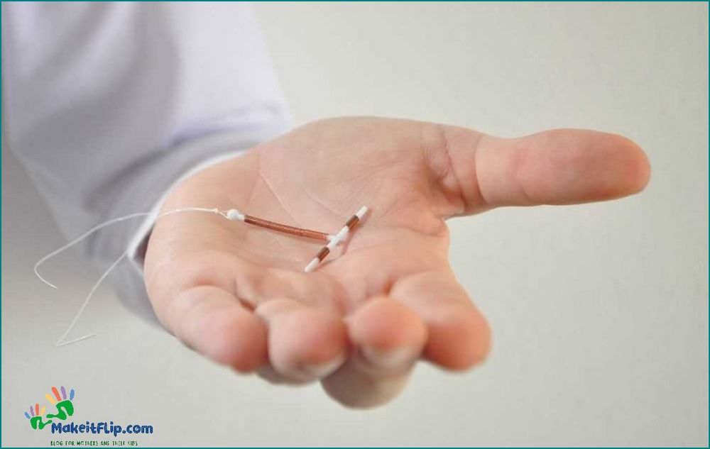 Can an IUD Fall Out Common Causes and What to Do