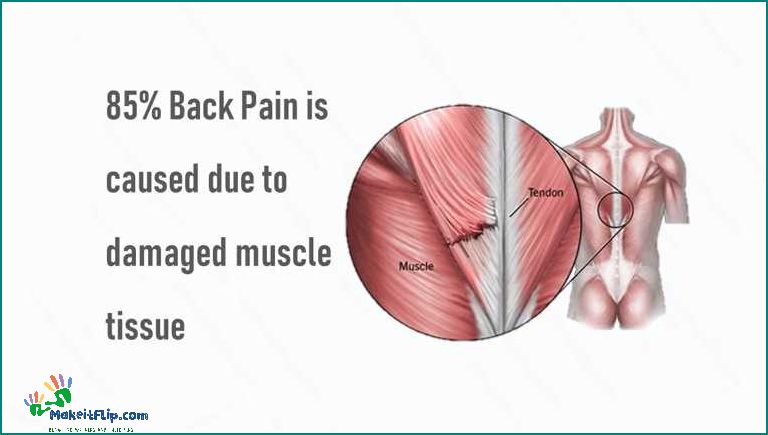 Causes and Treatment of Upper Back Pain on the Right Side