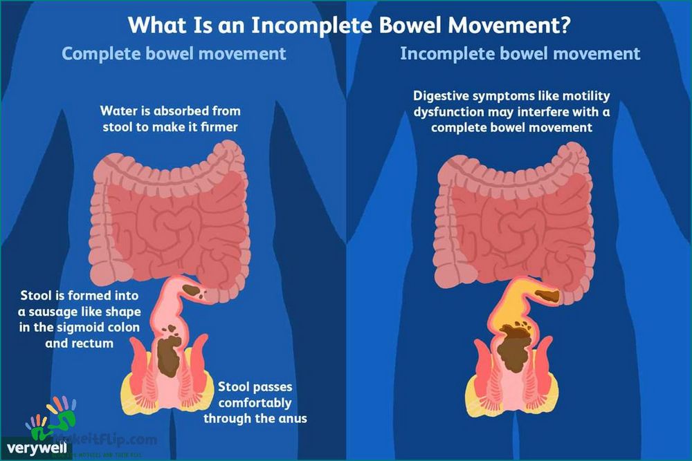 How to Hold in Poop Tips and Techniques for Controlling Bowel Movements