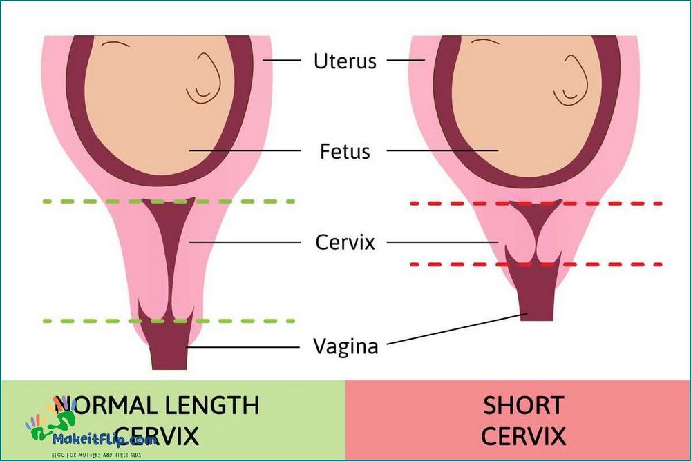 Understanding Low Hard Cervix at 4 Weeks Pregnant Causes and Solutions