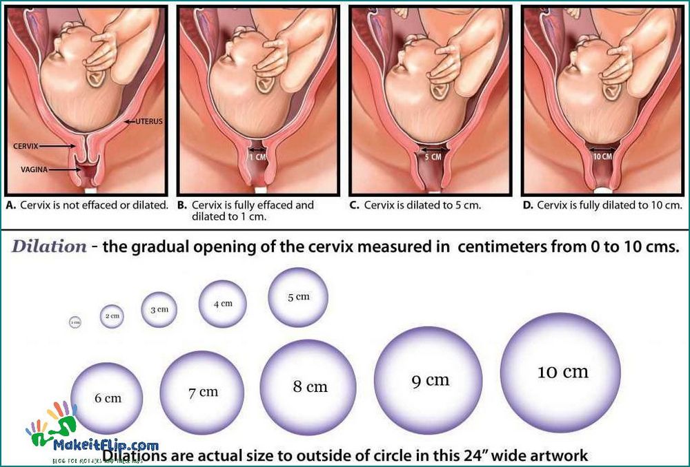 What to Expect During a Cervical Check During Pregnancy