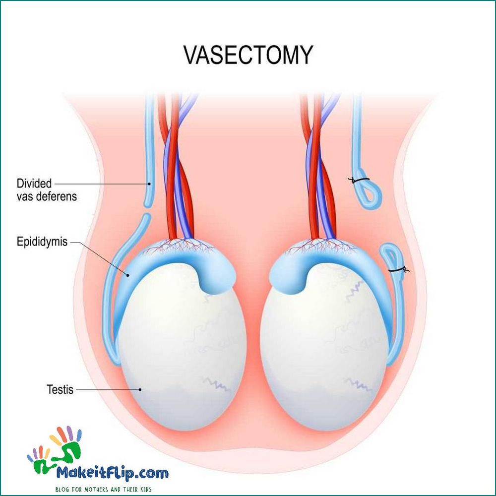 Chances of Pregnancy After Vasectomy What You Need to Know