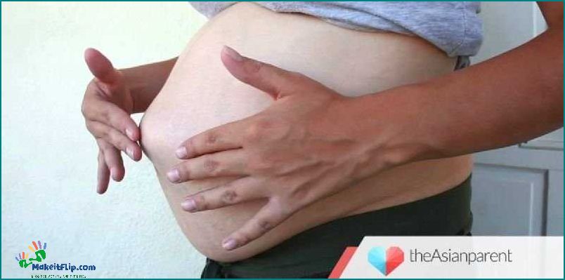 Hernia after pregnancy Causes Symptoms and Treatment