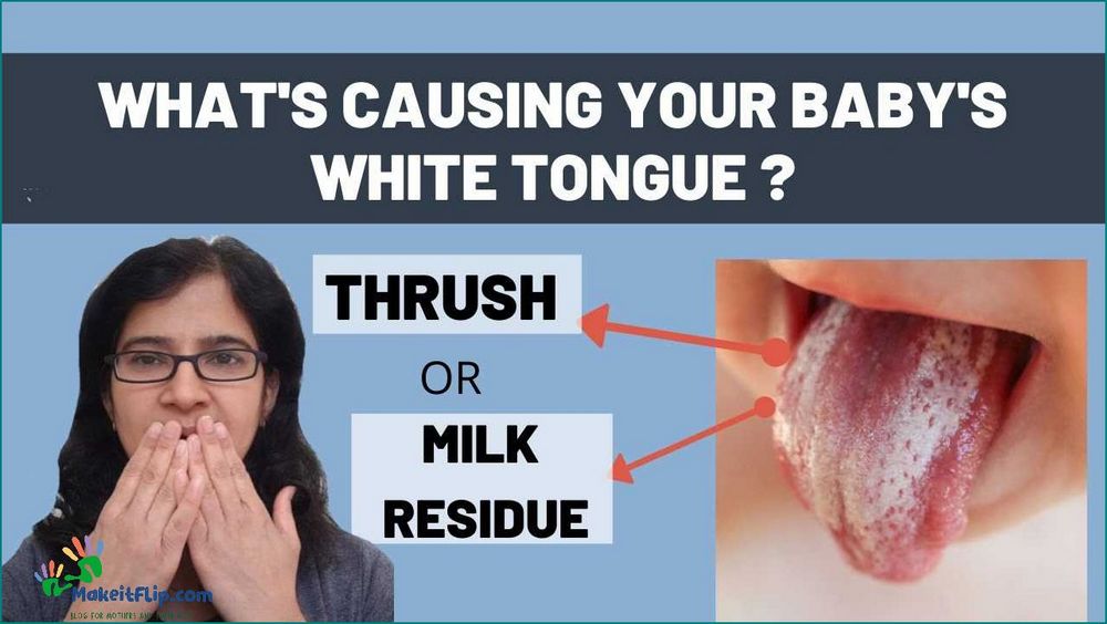 Milk Tongue vs Thrush Understanding the Difference and How to Treat Them