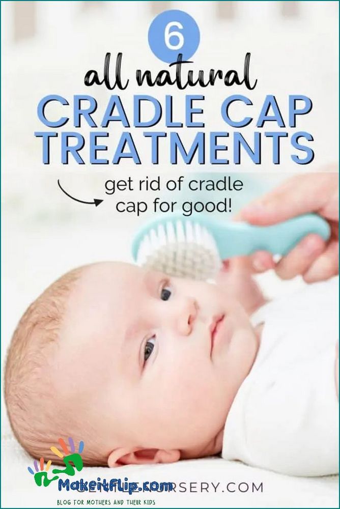 Olive Oil for Cradle Cap Natural Remedies for Baby's Scalp Condition