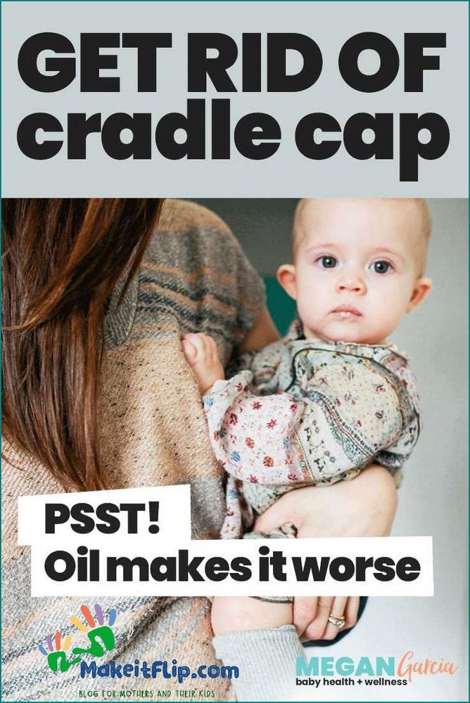 Olive Oil for Cradle Cap Natural Remedies for Baby's Scalp Condition