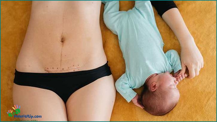 C-Section Scar Healing Stages What to Expect and How to Promote Healing