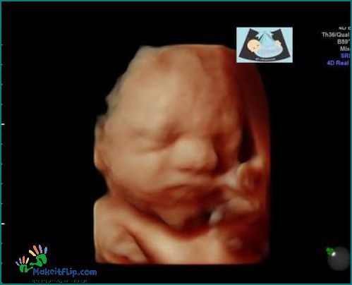 Discover the Wonders of 18 Week Ultrasound 3D Imaging