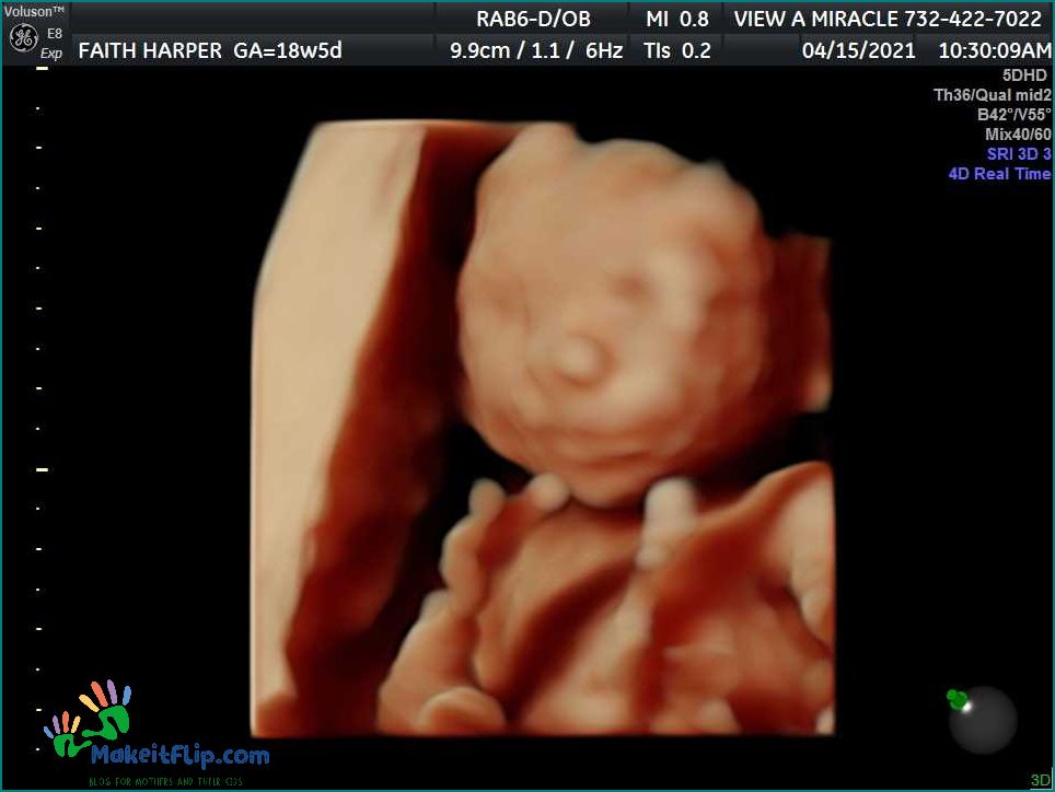 Discover the Wonders of 18 Week Ultrasound 3D Imaging