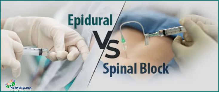 Epidural vs Spinal Understanding the Differences and Benefits