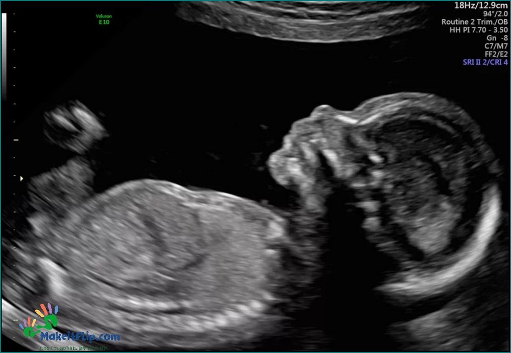 Everything You Need to Know About 19 Weeks Ultrasound