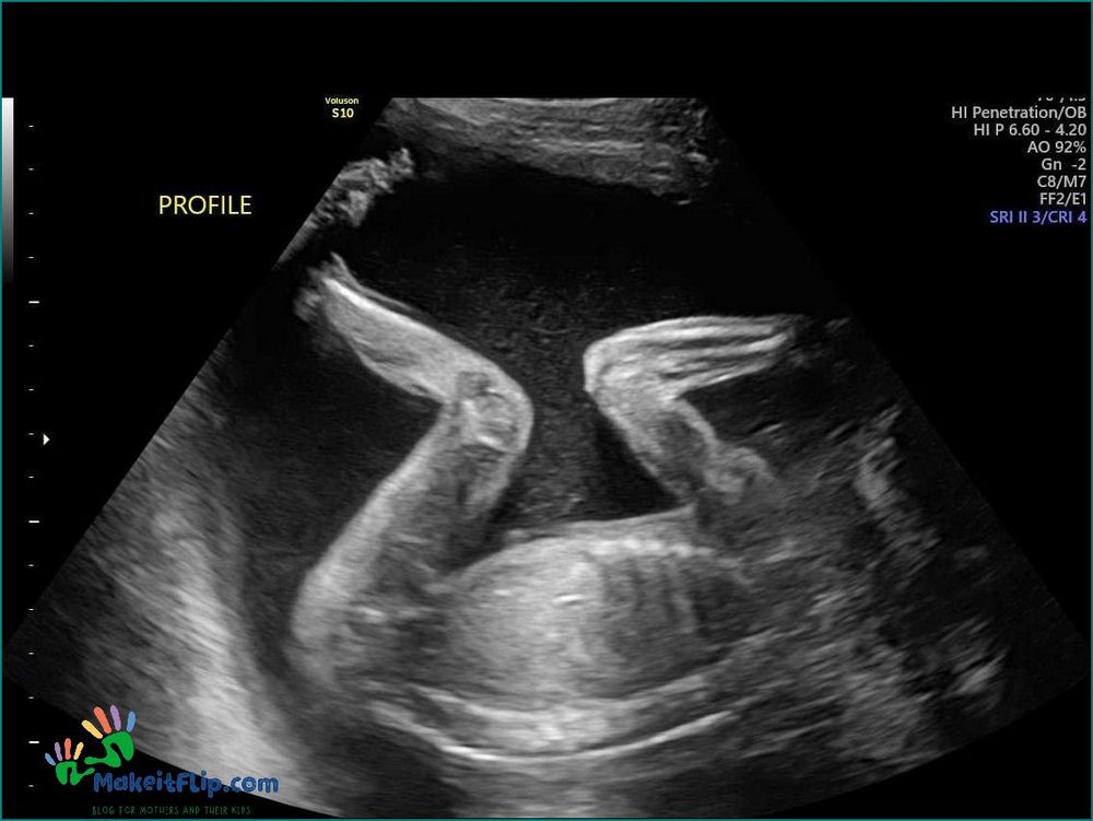Everything You Need to Know About 23 Week Ultrasound