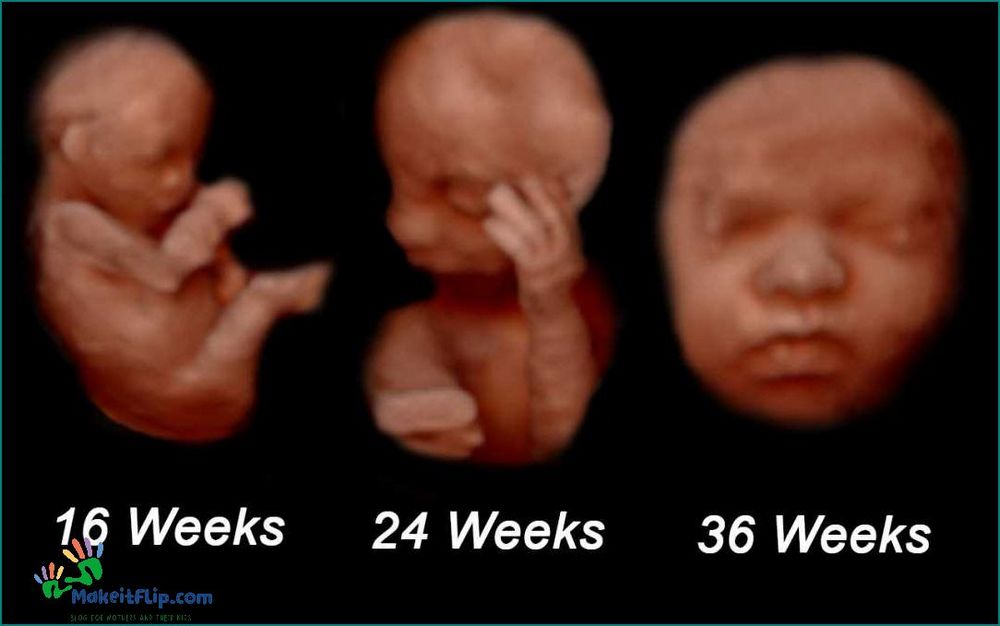Everything You Need to Know About 24 Week 3D Ultrasound