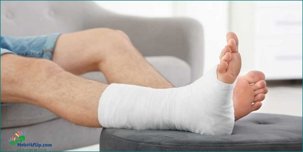 Everything you need to know about foot casts types benefits and care