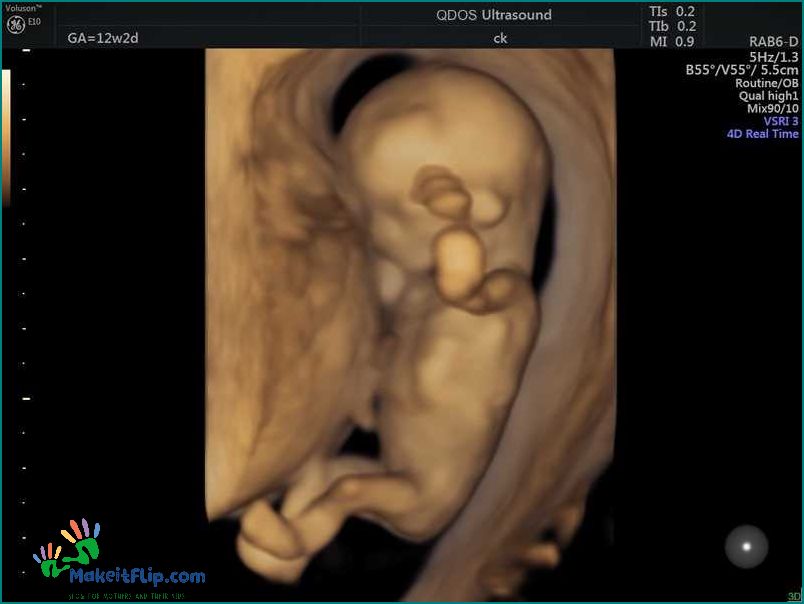 Everything You Need to Know About the 12 Week Ultrasound
