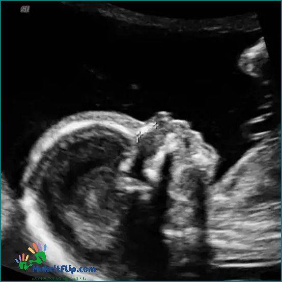 Everything You Need to Know About the 16 Week Ultrasound
