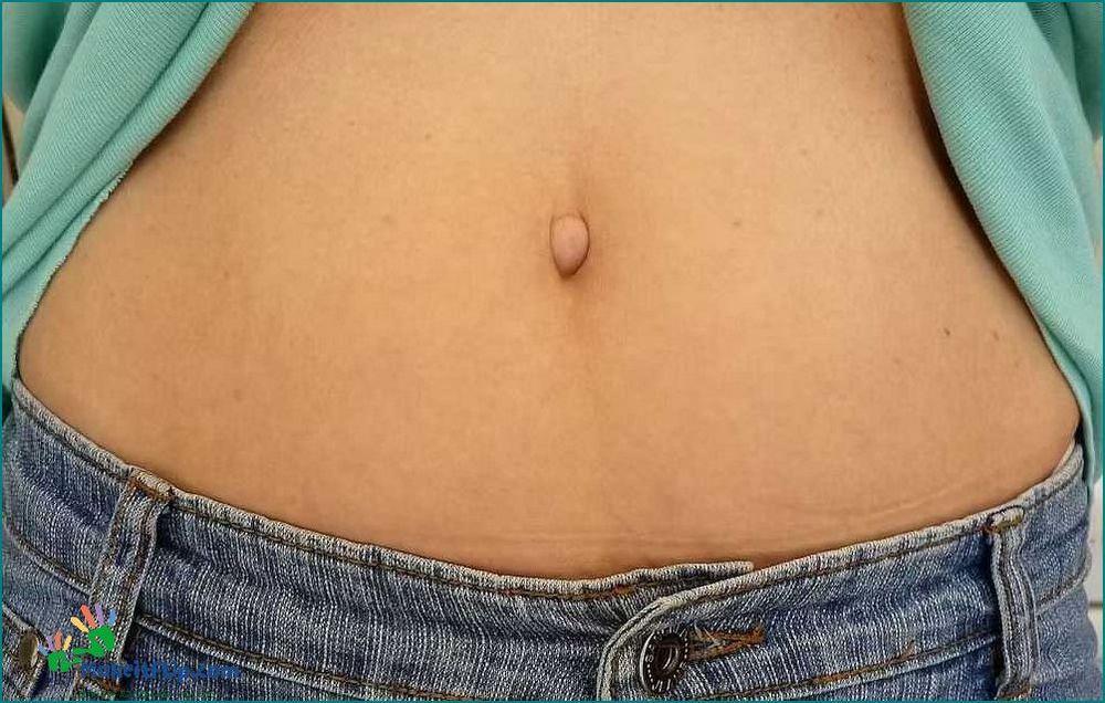 Exploring the Different Types of Belly Buttons A Comprehensive Guide