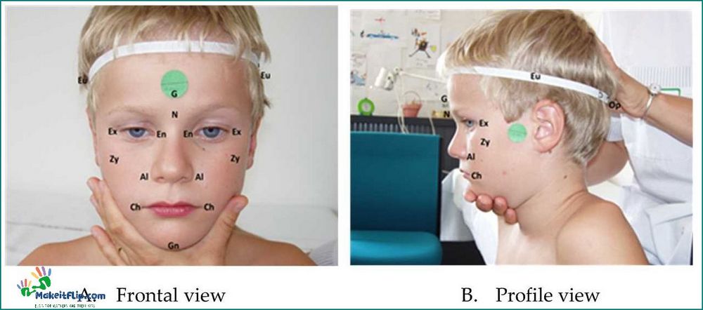 Facial Dysmorphia Test Identify and Understand Facial Differences