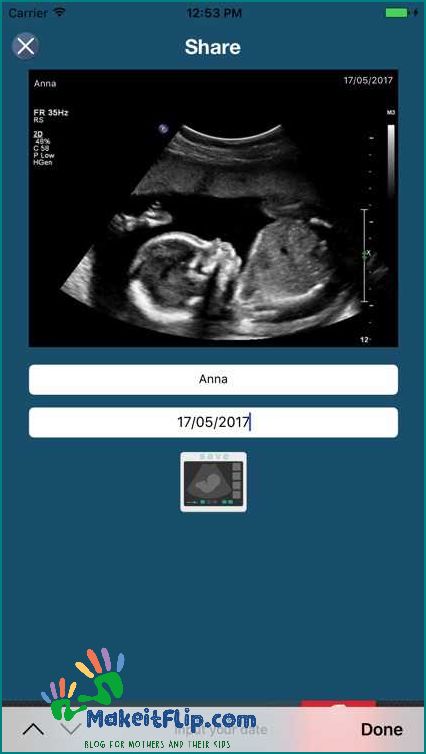 Fake Ultrasound - The Ultimate Guide to Creating and Using Fake Ultrasounds