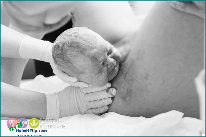 What is Baby Crowning and How Does it Happen During Childbirth