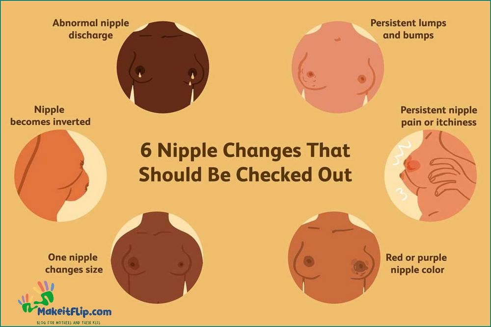 Causes and Treatment of White Spots on Nipples When Not Pregnant