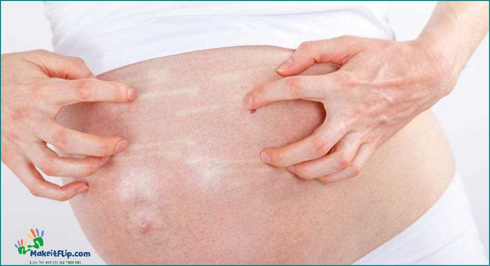 Dry Skin During Pregnancy Causes Symptoms and Remedies