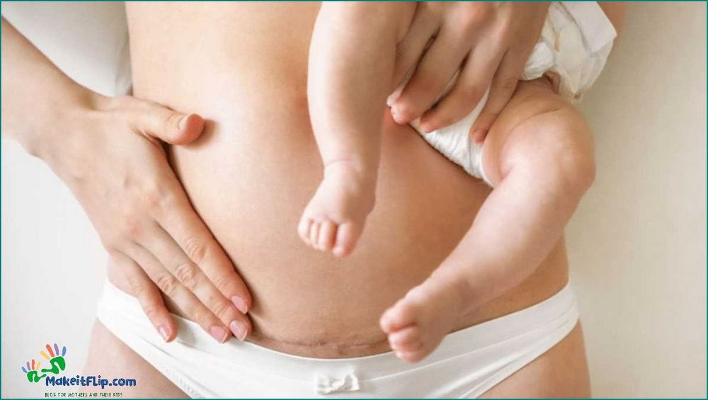 Get Rid of Your C Section Pouch with These Effective Tips