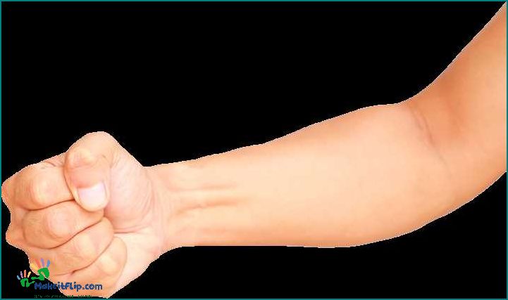 Hand Clenching Causes Symptoms and Treatment