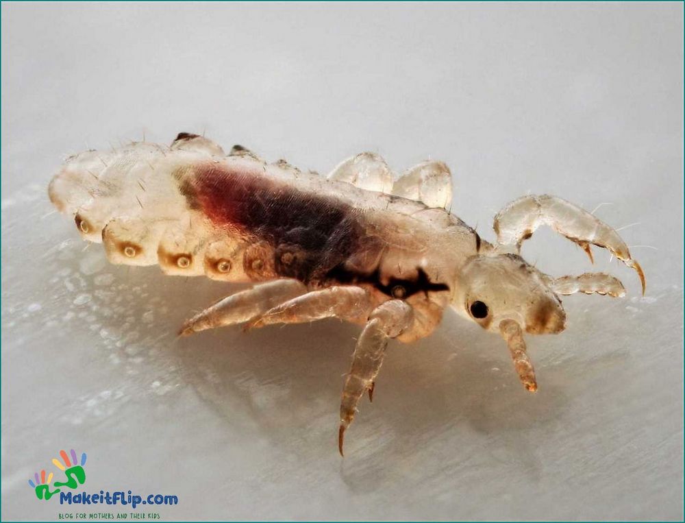 Head Lice Pictures Identifying and Treating Head Lice Infestations