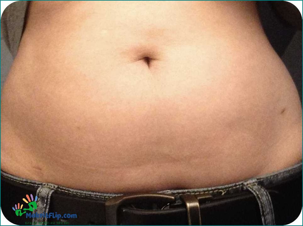 Healed Tubal Ligation Scars Understanding the Recovery Process