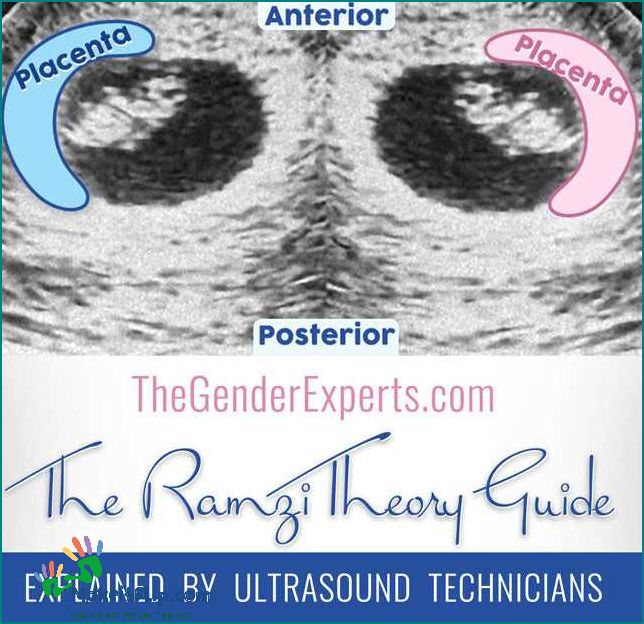 Understanding the Ramzi Theory A Guide to Predicting Baby's Gender