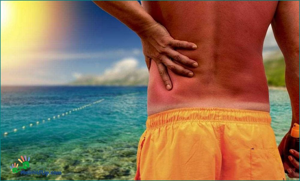How to Quickly Relieve Sunburn Itch Effective Remedies