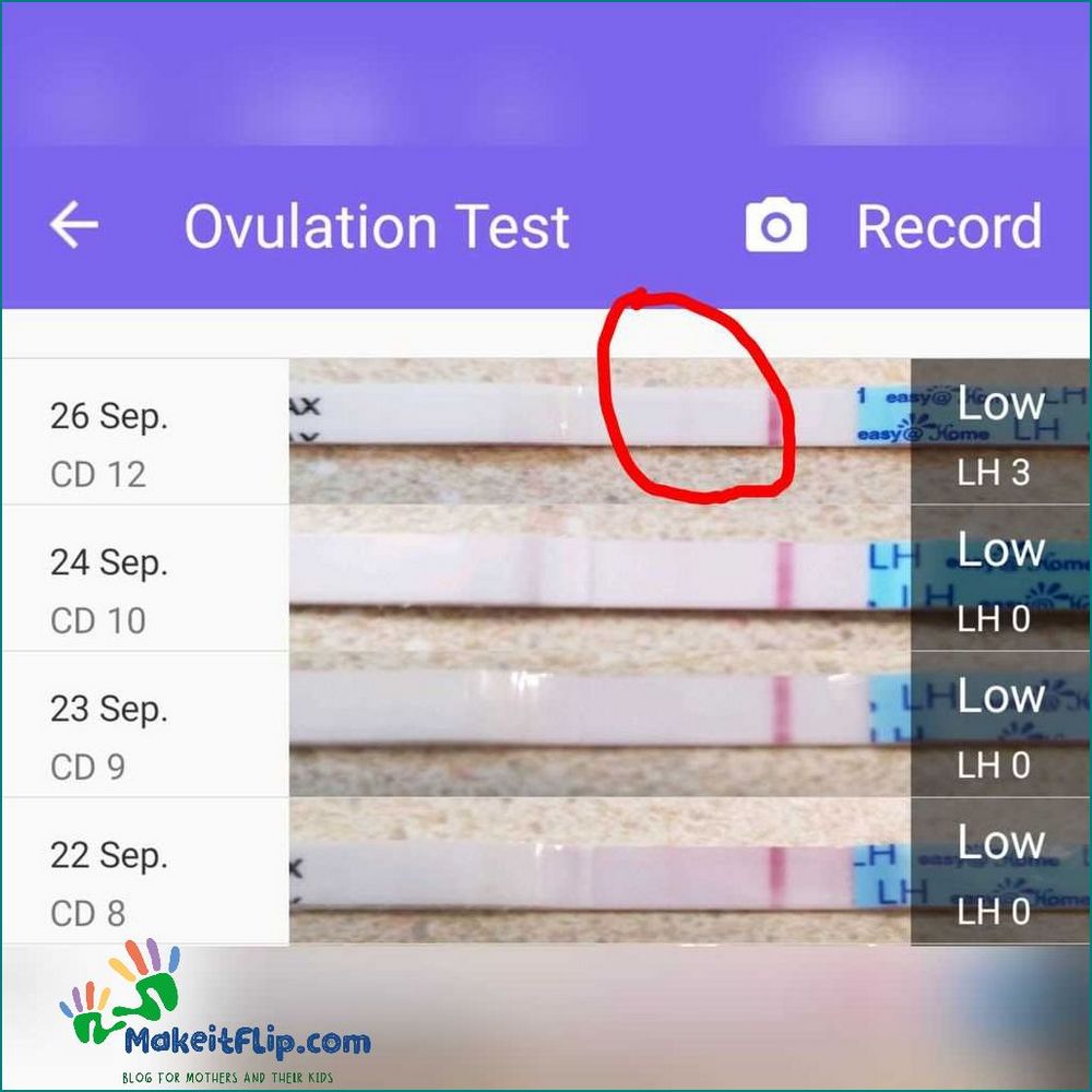 How to Track Ovulation After IUD Removal A Comprehensive Guide
