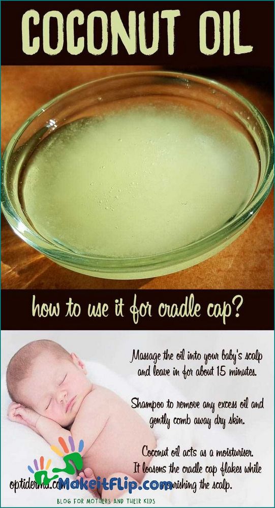 How to Use Coconut Oil for Cradle Cap A Natural Remedy