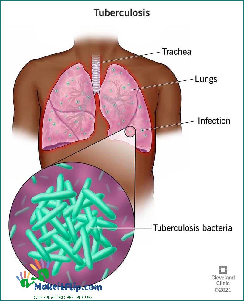 Is Upper Respiratory Infection Contagious Exploring the Transmission and Prevention