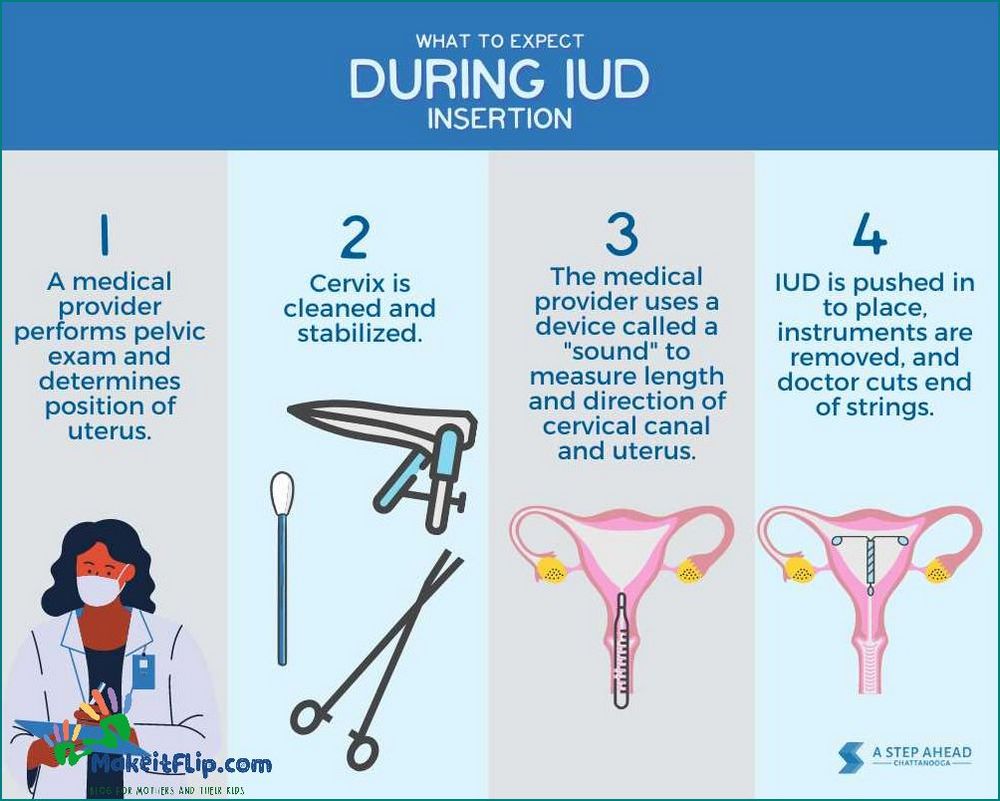 IUD vs Implant Which Birth Control Method is Right for You