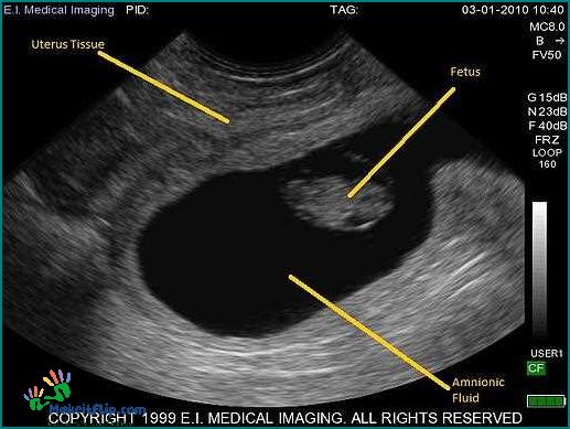 Learn How to Read an Ultrasound A Comprehensive Guide